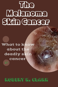 Melanoma Skin Cancer