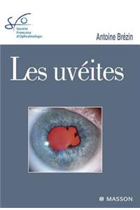 Les Uvéites