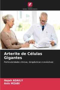 Arterite de Células Gigantes