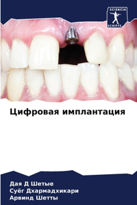 Цифровая имплантация