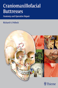 Craniomaxillofacial Buttresses