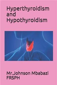 Hyperthyroidism and Hypothyroidism