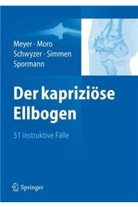 Der kapriziöse Ellbogen