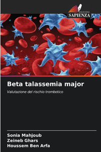 Beta talassemia major