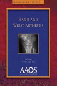 Hand and Wrist Arthritis