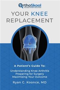 Your Knee Replacement