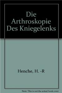 Die Arthroskopie Des Kniegelenks