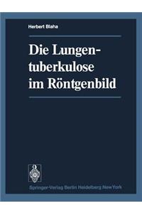 Die Lungentuberkulose Im Röntgenbild