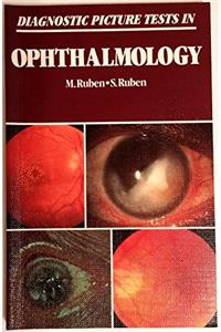 Diagnostic Picture Tests in Ophthalmology