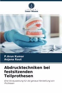 Abdrucktechniken bei festsitzenden Teilprothesen