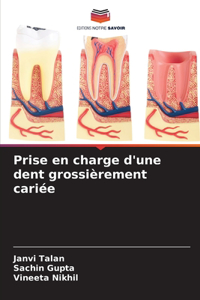 Prise en charge d'une dent grossièrement cariée