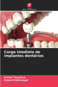 Carga imediata de implantes dentários