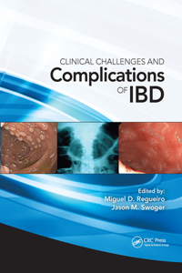 Clinical Challenges and Complications of IBD