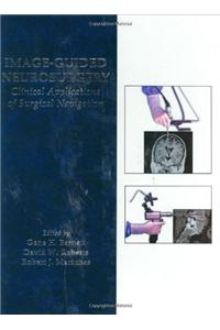 Image-guided Neurosurgery