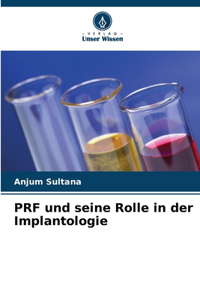 PRF und seine Rolle in der Implantologie