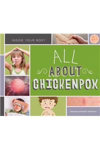 All about Chickenpox