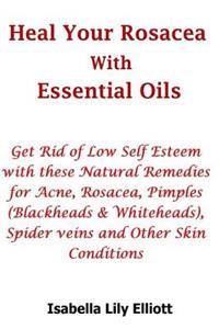 Heal Your Rosacea with Essential Oils