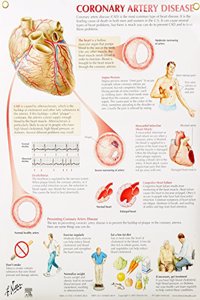 Coronary Artery Disease Chart