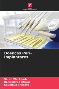 Doenças Peri-Implantares