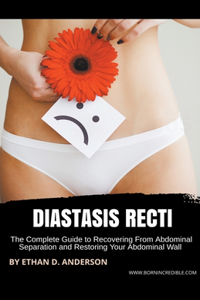 Diastasis Recti