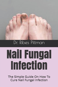 Nail Fungal Infection