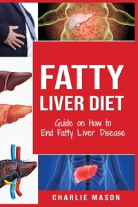 Fatty Liver Diet