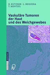 Vaskulare Tumoren Der Haut Und Des Weichgewebes