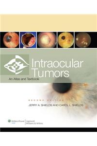 Intraocular Tumors