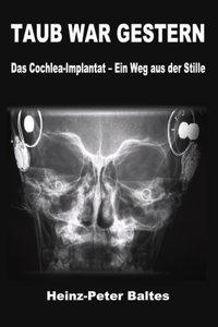 Taub War Gestern
