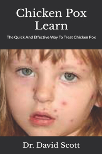 Chicken Pox Learn