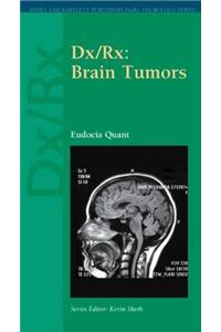 DX/Rx: Brain Tumors