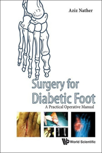 Surgery for Diabetic Foot