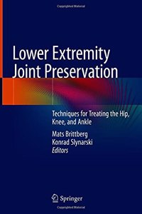 Lower Extremity Joint Preservation