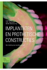 Implantaten En Prothetische Constructies