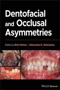 Dentofacial and Occlusal Asymmetries