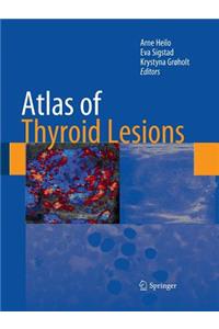 Atlas of Thyroid Lesions