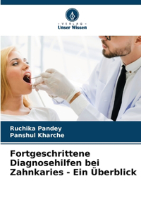 Fortgeschrittene Diagnosehilfen bei Zahnkaries - Ein Überblick
