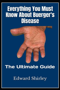 Everything You Must Know About Buerger's Disease