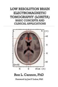 Low Resolution Brain Electromagnetic Tomography (LORETA)