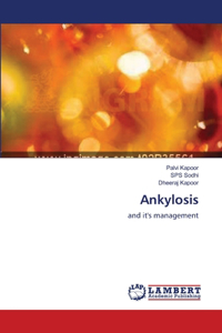 Ankylosis