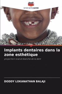 Implants dentaires dans la zone esthétique