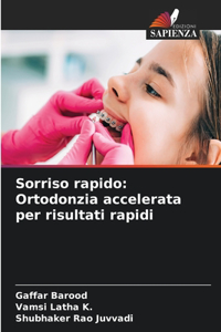 Sorriso rapido