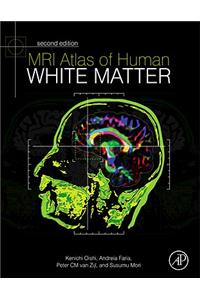 MRI Atlas of Human White Matter