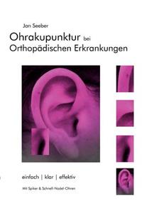 Ohrakupunktur bei Orthopädischen Erkrankungen