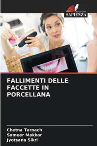 Fallimenti Delle Faccette in Porcellana