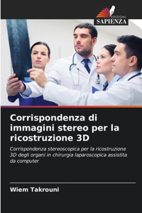 Corrispondenza di immagini stereo per la ricostruzione 3D