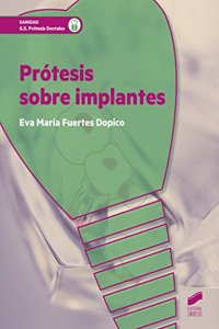Protesis sobre implantes