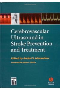 Cerebrovascular Ultrasound in Stroke Prevention and Treatment