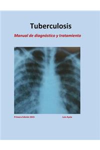 Tratamiento de Tuberculosis