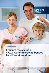 Fracture resistance of CAD/CAM endocrowns bonded by different bonding